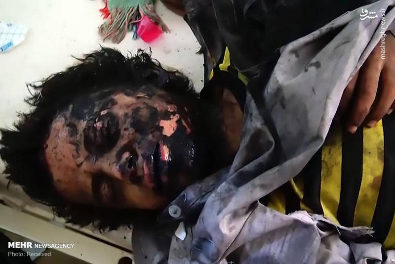 عکس/ حمله وحشیانه جنگنده سعودی به دانش‌آموزان یمنی